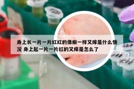 身上长一片一片红红的像癣一样又痒是什么情况 身上起一片一片红的又痒是怎么了