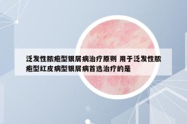 泛发性脓疱型银屑病治疗原则 用于泛发性脓疱型红皮病型银屑病首选治疗的是 