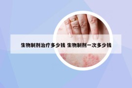 生物制剂治疗多少钱 生物制剂一次多少钱