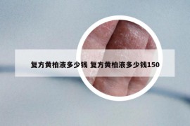 复方黄柏液多少钱 复方黄柏液多少钱150