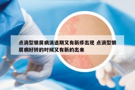 点滴型银屑病消退期又有新疹出现 点滴型银屑病好转的时候又有新的出来