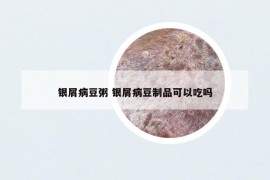 银屑病豆粥 银屑病豆制品可以吃吗