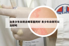 治青少年白斑去哪家医院好 青少年白斑可以治好吗