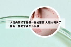 大腿内侧长了像癣一样的东西 大腿内侧长了像癣一样的东西怎么回事