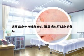 银屑病吃十八味党参丸 银屑病人可以吃党参吗