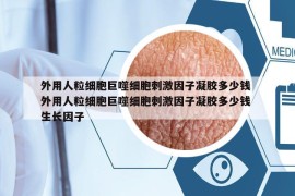 外用人粒细胞巨噬细胞刺激因子凝胶多少钱 外用人粒细胞巨噬细胞刺激因子凝胶多少钱 生长因子