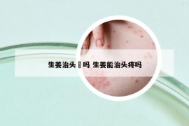 生姜治头廯吗 生姜能治头疼吗