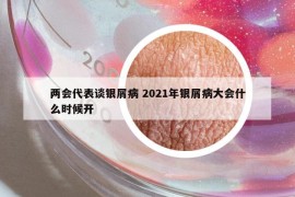 两会代表谈银屑病 2021年银屑病大会什么时候开
