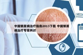 中国银屑病治疗指南2013下载 中国银屑病治疗专家共识