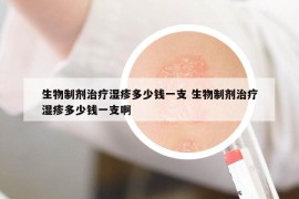 生物制剂治疗湿疹多少钱一支 生物制剂治疗湿疹多少钱一支啊