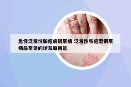 急性泛发性脓疱病银屑病 泛发性脓疱型银屑病最常见的诱发原因是