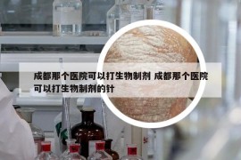 成都那个医院可以打生物制剂 成都那个医院可以打生物制剂的针