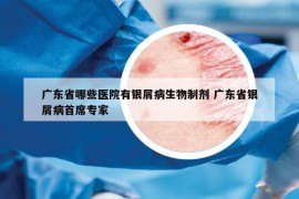 广东省哪些医院有银屑病生物制剂 广东省银屑病首席专家
