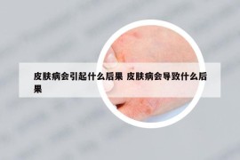 皮肤病会引起什么后果 皮肤病会导致什么后果