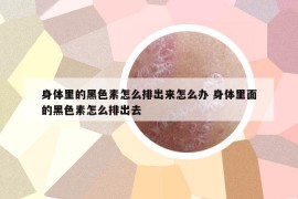 身体里的黑色素怎么排出来怎么办 身体里面的黑色素怎么排出去