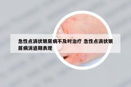 急性点滴状银屑病不及时治疗 急性点滴状银屑病消退期表现
