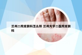 兰州二院皮肤科怎么样 兰州大学二医院皮肤科