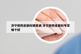 济宁附院皮肤科银屑病 济宁附院皮肤科专家哪个好