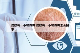 皮肤有一小块白斑 皮肤有一小块白斑怎么回事