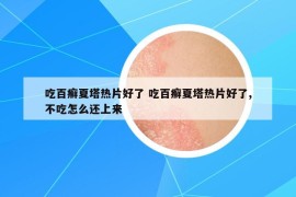 吃百癣夏塔热片好了 吃百癣夏塔热片好了,不吃怎么还上来