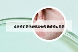 吃治癣的药还能喝三七吗 治疗癣口服药