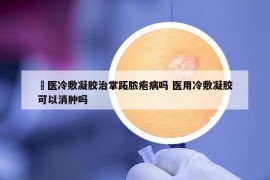 芃医冷敷凝胶治掌跖脓疱病吗 医用冷敷凝胶可以消肿吗