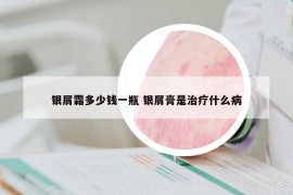 银屑霜多少钱一瓶 银屑膏是治疗什么病