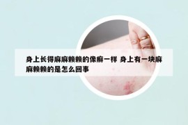 身上长得麻麻赖赖的像癣一样 身上有一块麻麻赖赖的是怎么回事