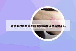 纬度低对银屑病影响 银屑病和温度有关系吗
