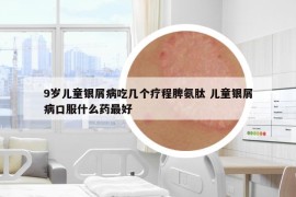 9岁儿童银屑病吃几个疗程脾氨肽 儿童银屑病口服什么药最好