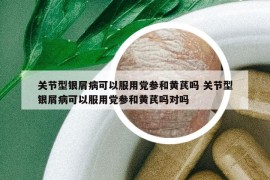关节型银屑病可以服用党参和黄芪吗 关节型银屑病可以服用党参和黄芪吗对吗