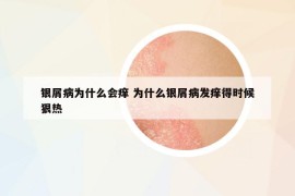 银屑病为什么会痒 为什么银屑病发痒得时候狠热