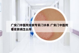 广安门中医院皮肤专家门诊表 广安门中医院看皮肤病怎么样