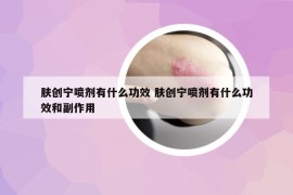 肤创宁喷剂有什么功效 肤创宁喷剂有什么功效和副作用