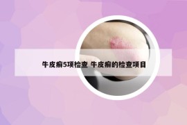 牛皮癣5项检查 牛皮癣的检查项目