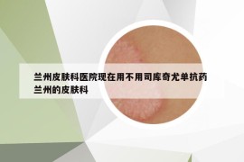 兰州皮肤科医院现在用不用司库奇尤单抗药 兰州的皮肤科