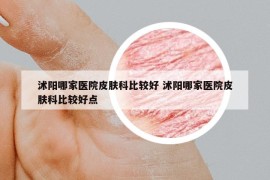 沭阳哪家医院皮肤科比较好 沭阳哪家医院皮肤科比较好点