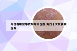 海口有哪些牛皮癣专科医院 海口十大皮肤病医院