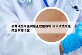 黑龙江盛京医院是正规医院吗 哈尔滨盛京医院属于哪个区