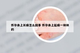怀孕身上长癣怎么回事 怀孕身上起癣一块块的
