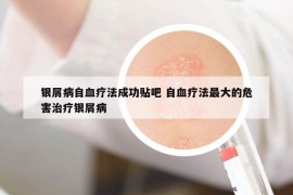 银屑病自血疗法成功贴吧 自血疗法最大的危害治疗银屑病