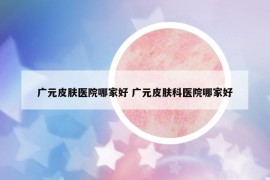 广元皮肤医院哪家好 广元皮肤科医院哪家好
