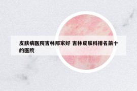 皮肤病医院吉林那家好 吉林皮肤科排名前十的医院