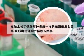皮肤上长了很多那种像癣一样的东西是怎么回事 皮肤出现像癣一样怎么回事