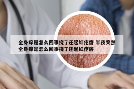 全身痒是怎么回事挠了还起红疙瘩 半夜突然全身痒是怎么回事挠了还起红疙瘩