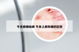 牛皮癣癞蛤蟆 牛身上癣和癞的区别