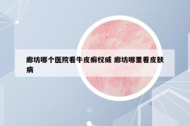 廊坊哪个医院看牛皮癣权威 廊坊哪里看皮肤病