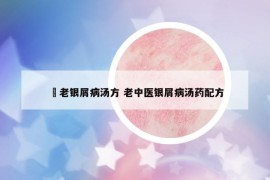 禤老银屑病汤方 老中医银屑病汤药配方