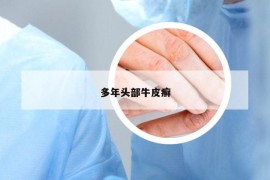 多年头部牛皮癣