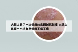 大腿上长了一块像癣的东西越抓越痒 大腿上出现一小块有点像癣不痛不痒